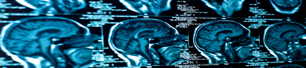 Untitled-1 Untitled-13 Traumatic Brain Injuries